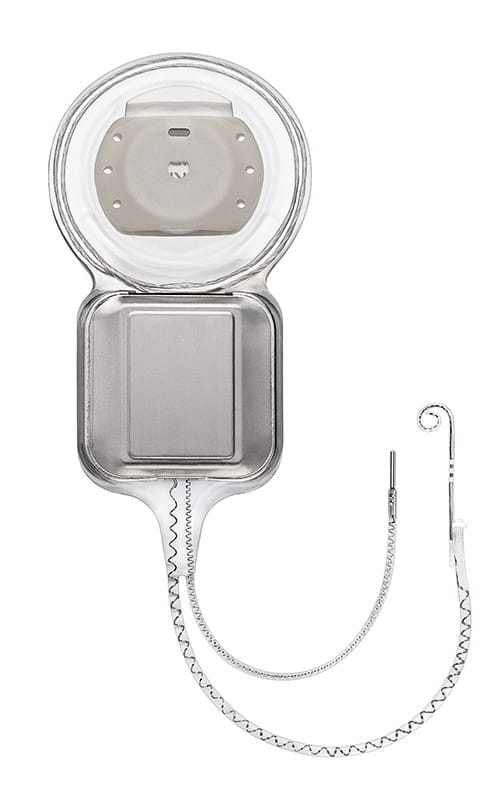 A Cochlear Implant