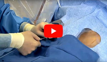 Implanting the CardioMEMS sensor at UH