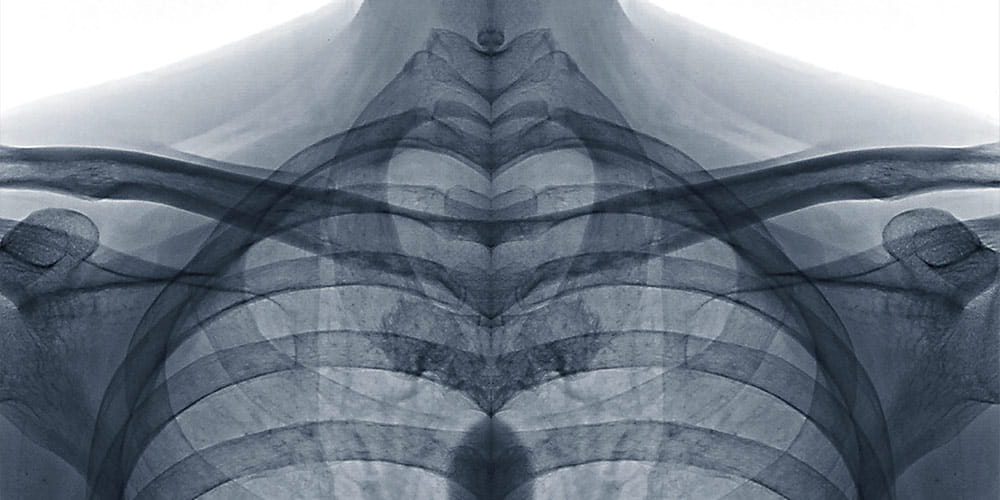 X-ray view of upper chest
