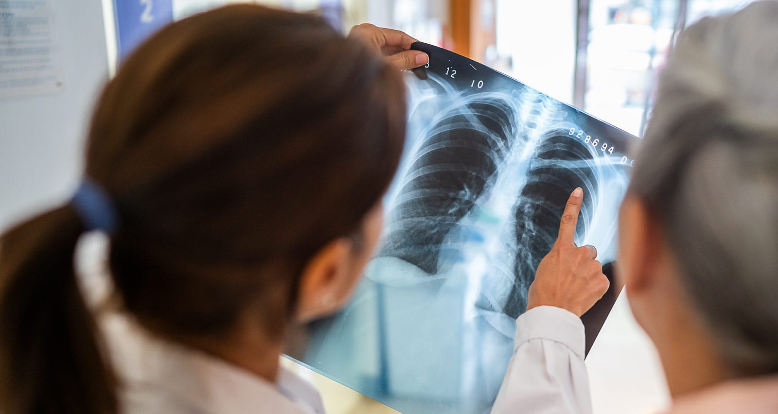 Two female doctors examining and discussing a chest X-ray film in a clinical setting