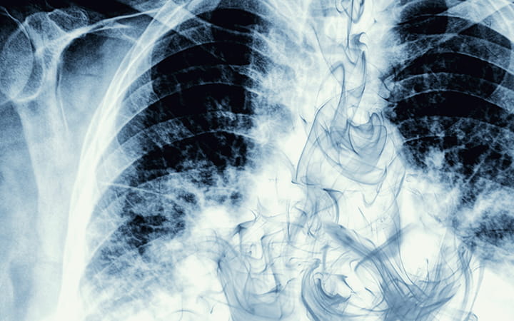 Vaping May Be More Dangerous Than Cigarette Smoking, Studies Show | University Hospitals Vaping May Be More Dangerous Than Cigarette Smoking, Studies Show | University Hospitals