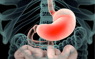 How To Prevent and Find Relief From Acid Reflux