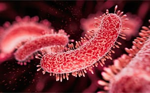 What to Know About Legionnaires’ Disease