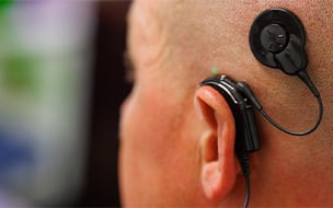 The Sound of Celebration: 30 Years of Cochlear Implants at UH