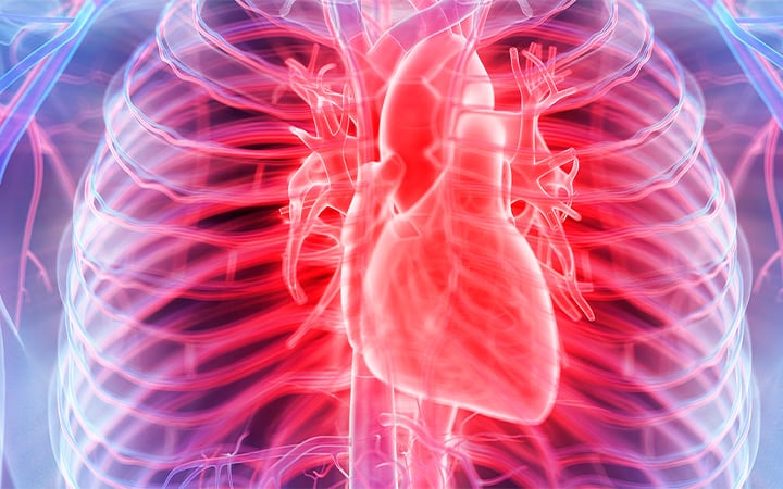 An illustration of heart disease