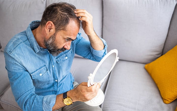 Man examines his receding hair line in mirror