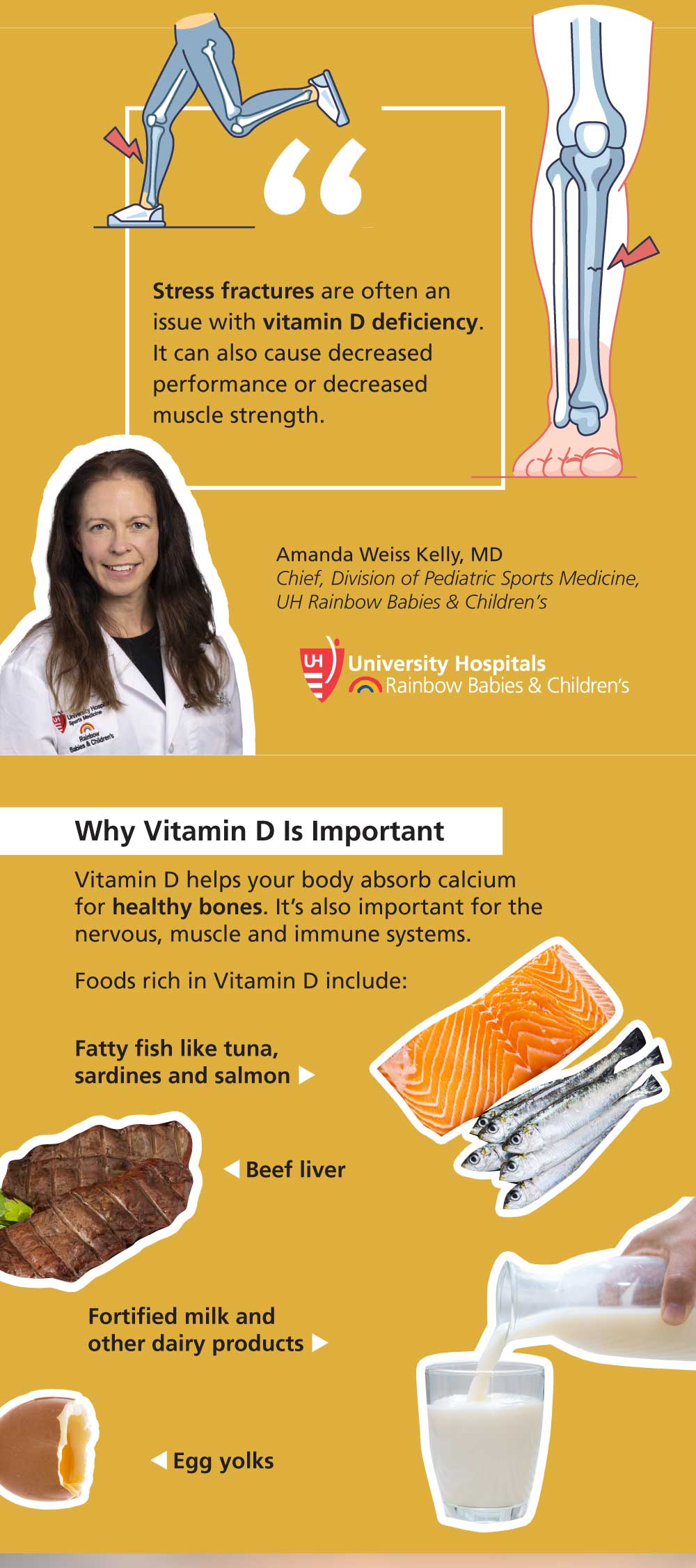 Infographic: Low Vitamin D: A Hidden Cause of Fractures in Young Athletes (2/5)