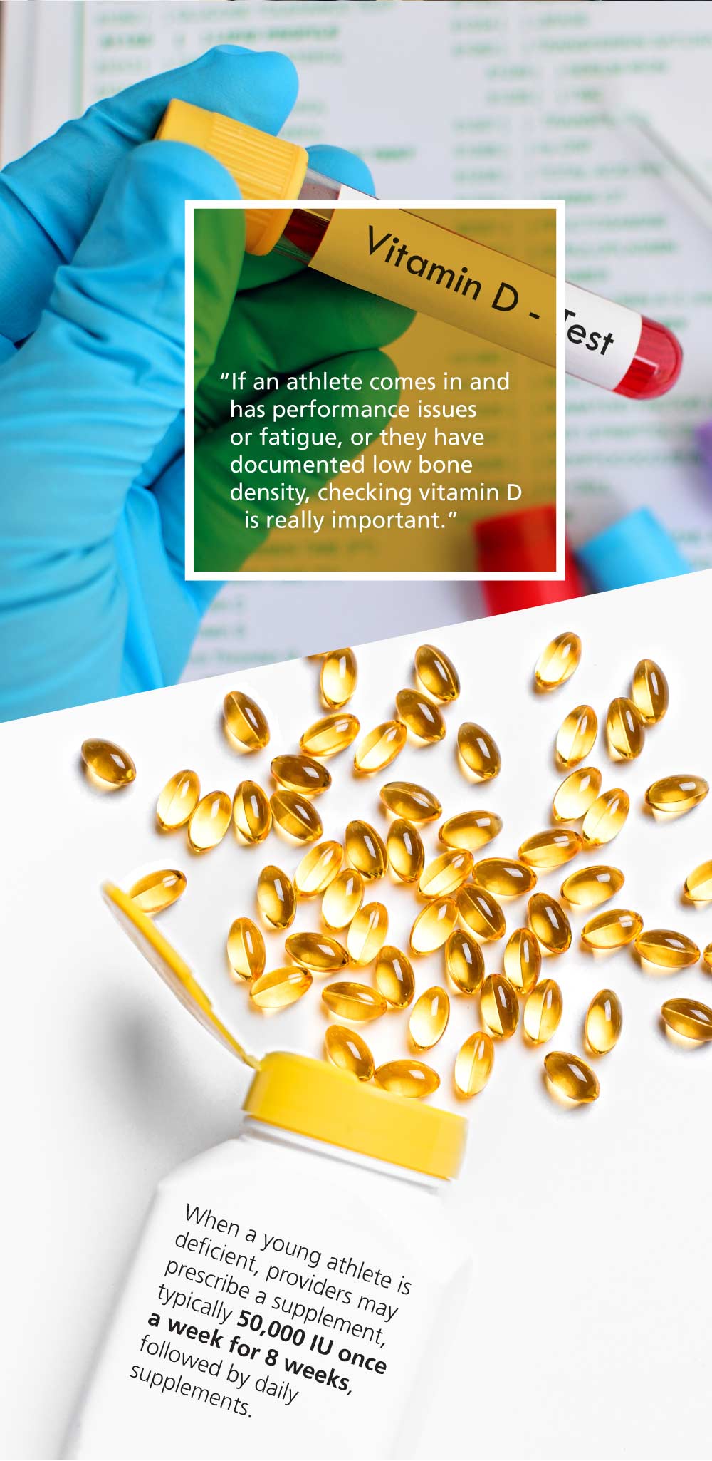 Infographic: Low Vitamin D: A Hidden Cause of Fractures in Young Athletes (5/5)