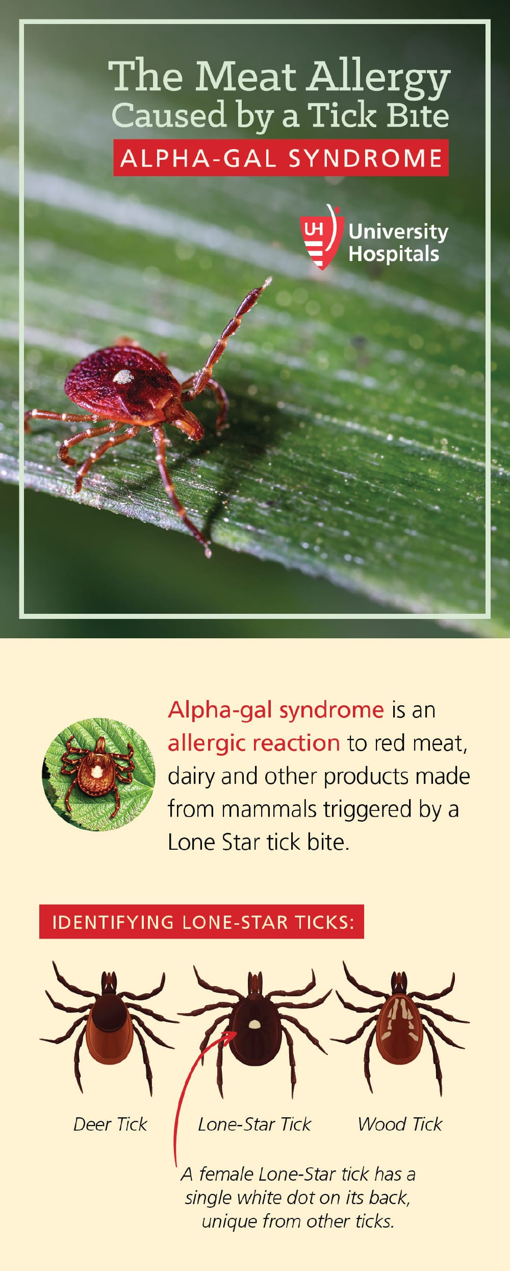 Infographic: The Meat Allergy Caused by a Tick Bite: Alpha-Gal Syndrome