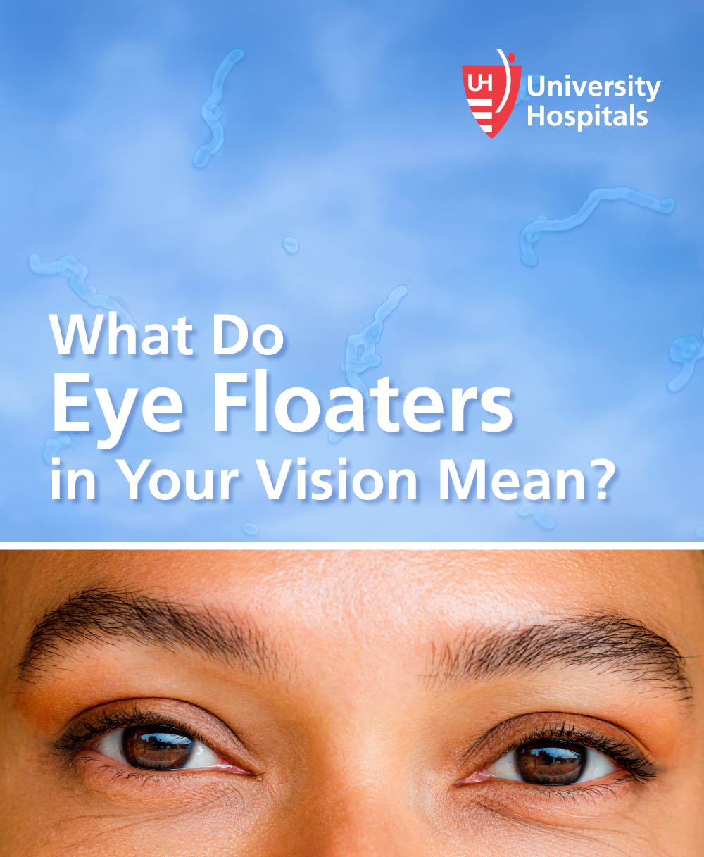 Infographic: What Do Eye Floaters in Your Vision Mean?