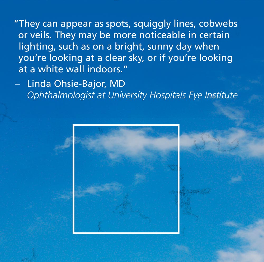 Infographic: What Do Eye Floaters in Your Vision Mean?