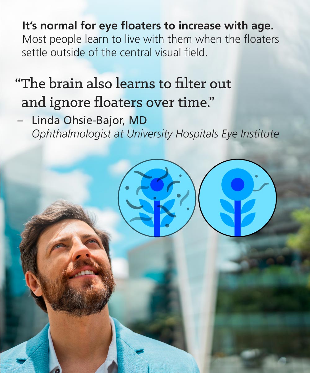 Infographic: What Do Eye Floaters in Your Vision Mean?