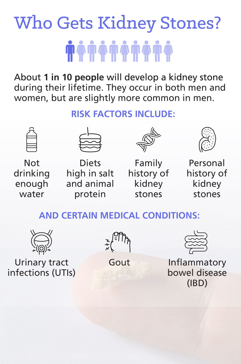 Kidney Stones: Know the Signs, Lower Your Risk