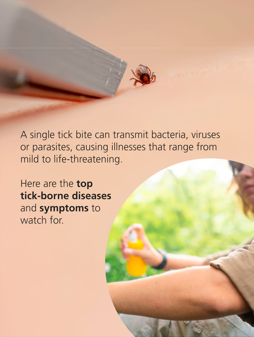 Infographic: Top 7 Tick Illnesses in the Midwest