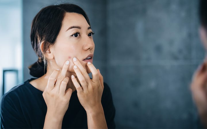 A young Asian woman standing in front of bathroom mirror, gently touching her face and examining unhealthy skin with red patches
