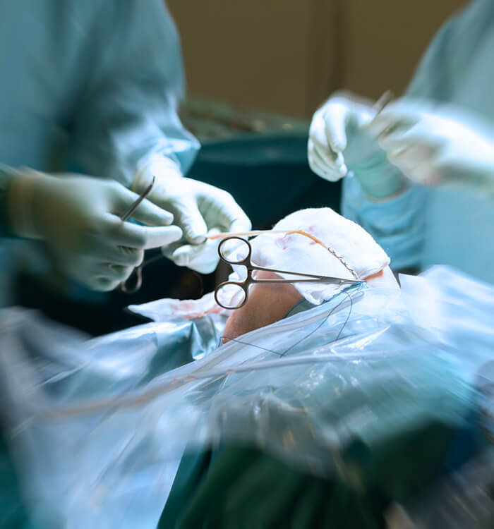 ACL repair illustration