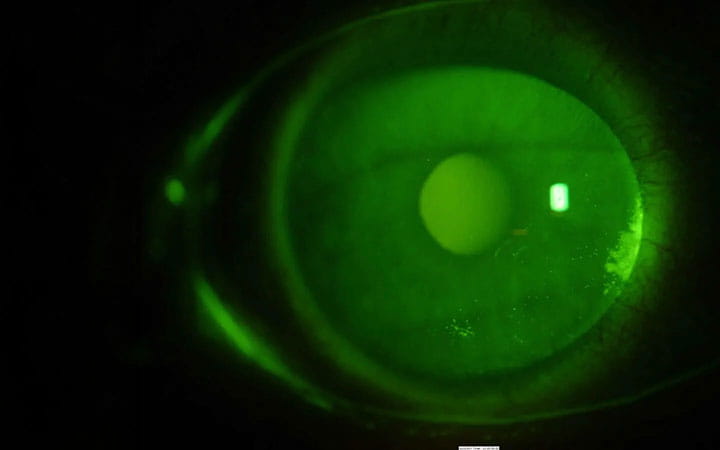 Up close image of cornea scan in green color.
