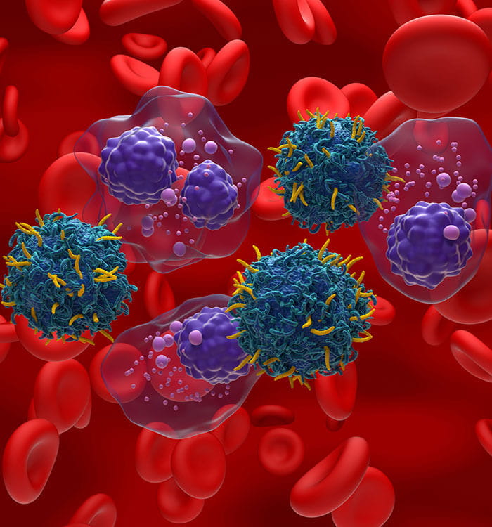 CAR T cell therapy in Multiple myeloma (MM) - isometric view 3d illustration.