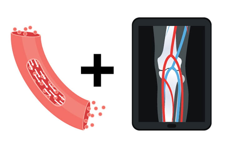 Illustration of vascular vessel and bone scan depicting collaboration between Cardiovascular and Orthopaedics.