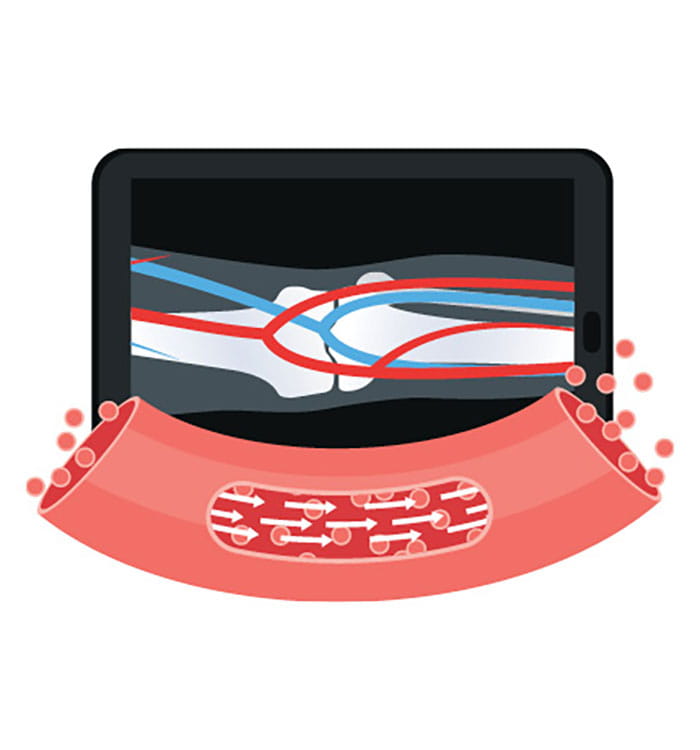 Illustration depicting collaboration of cardiovascular and orthopaedic medicine.