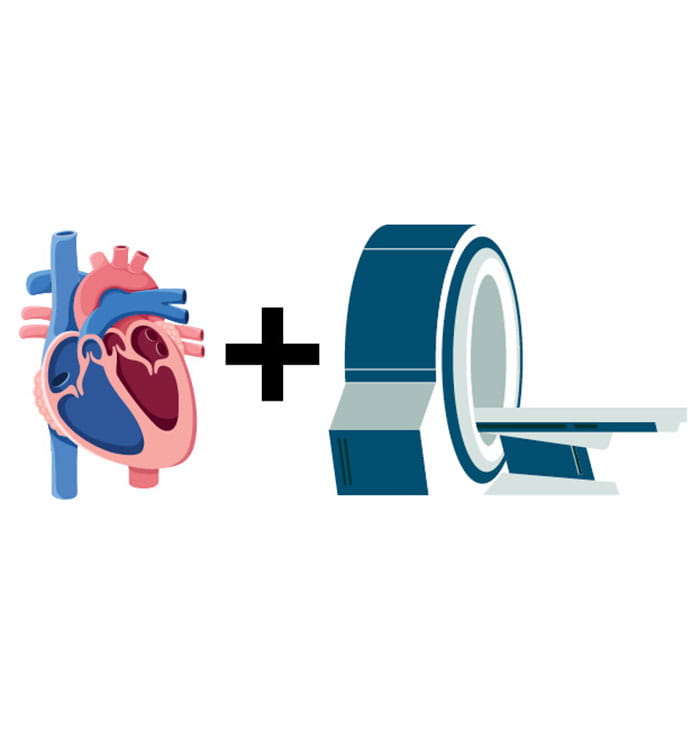Illustration of heart and MRI machine depicting collaboration between Cardiovascular and RadOnc.