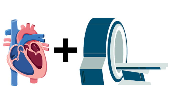 Illustration of heart and MRI machine depicting collaboration between Cardiovascular and RadOnc.