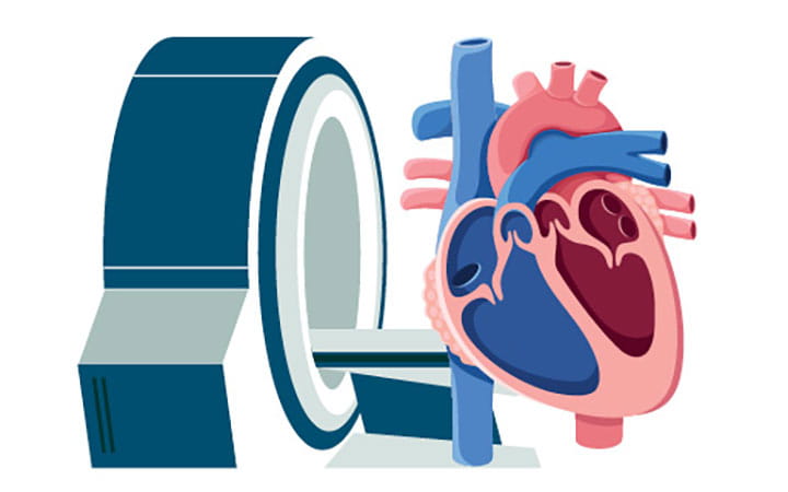 Illustration depicting collaboration of cardiovascular and radiation-oncology medicine.