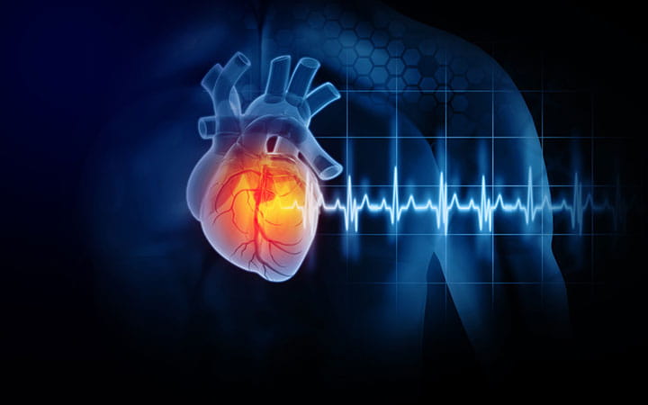 3D Illustration depicting heart attack and heart rhythm.
