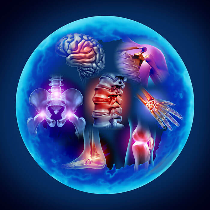 Illustration showing inflammation in various parts of the body.