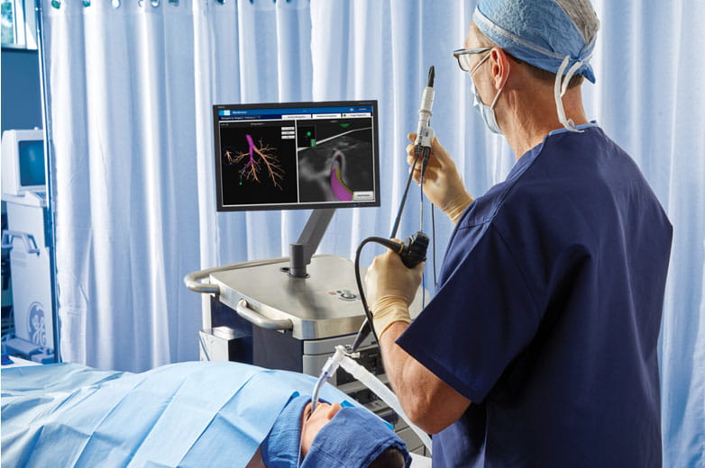 Navigational Bronchoscopy in Endoscopy.