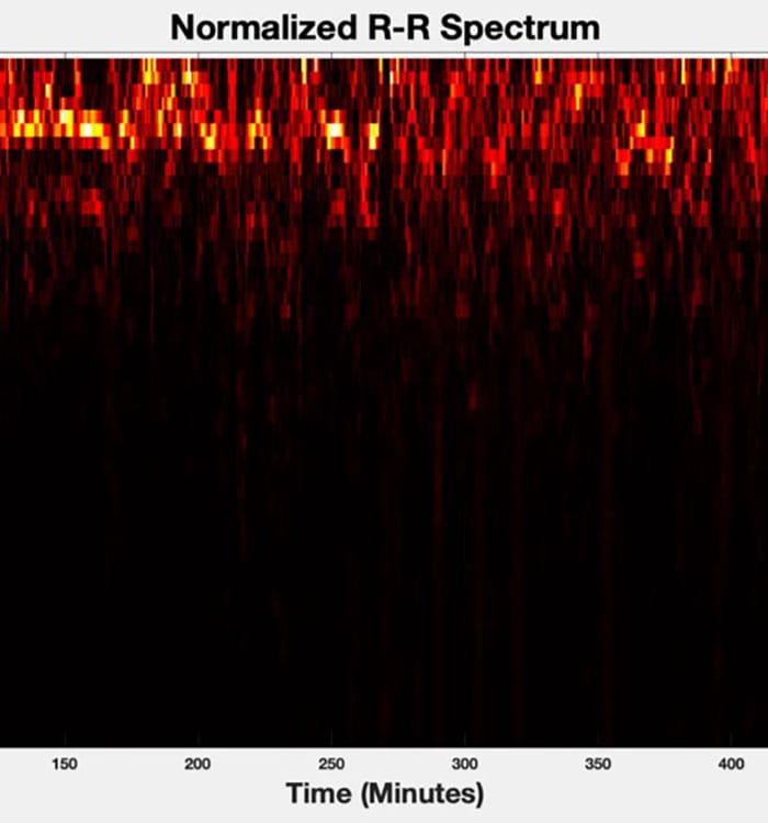 The spectrum of R-R intervals for a sample sleep study.