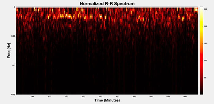 The spectrum of R-R intervals for a sample sleep study