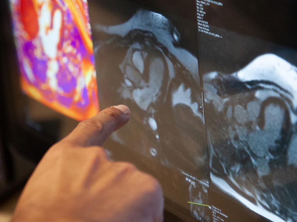 hand pointing to a section of a heart image