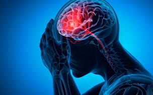 3D Illustration of an x-ray depicting a brain stroke