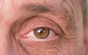 How Diabetes Affects Your Eyes