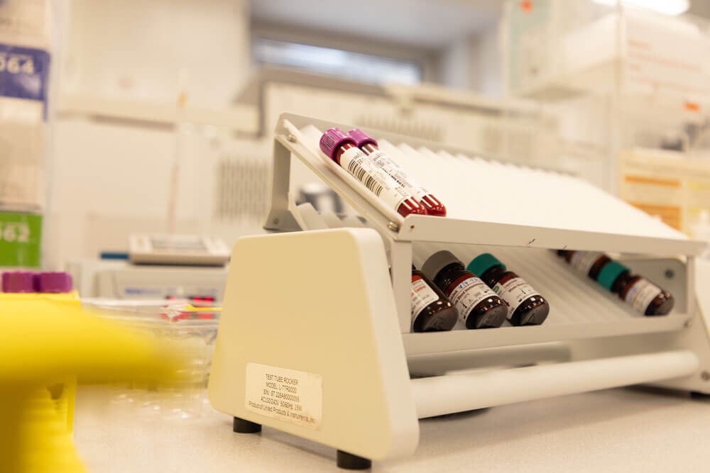 lab with blood samples ready for testing