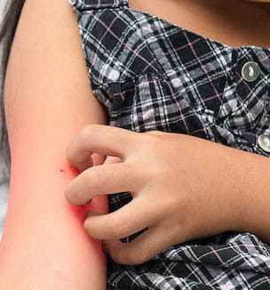 Skin irritation