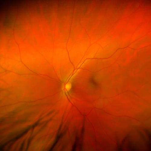 retina in human eye