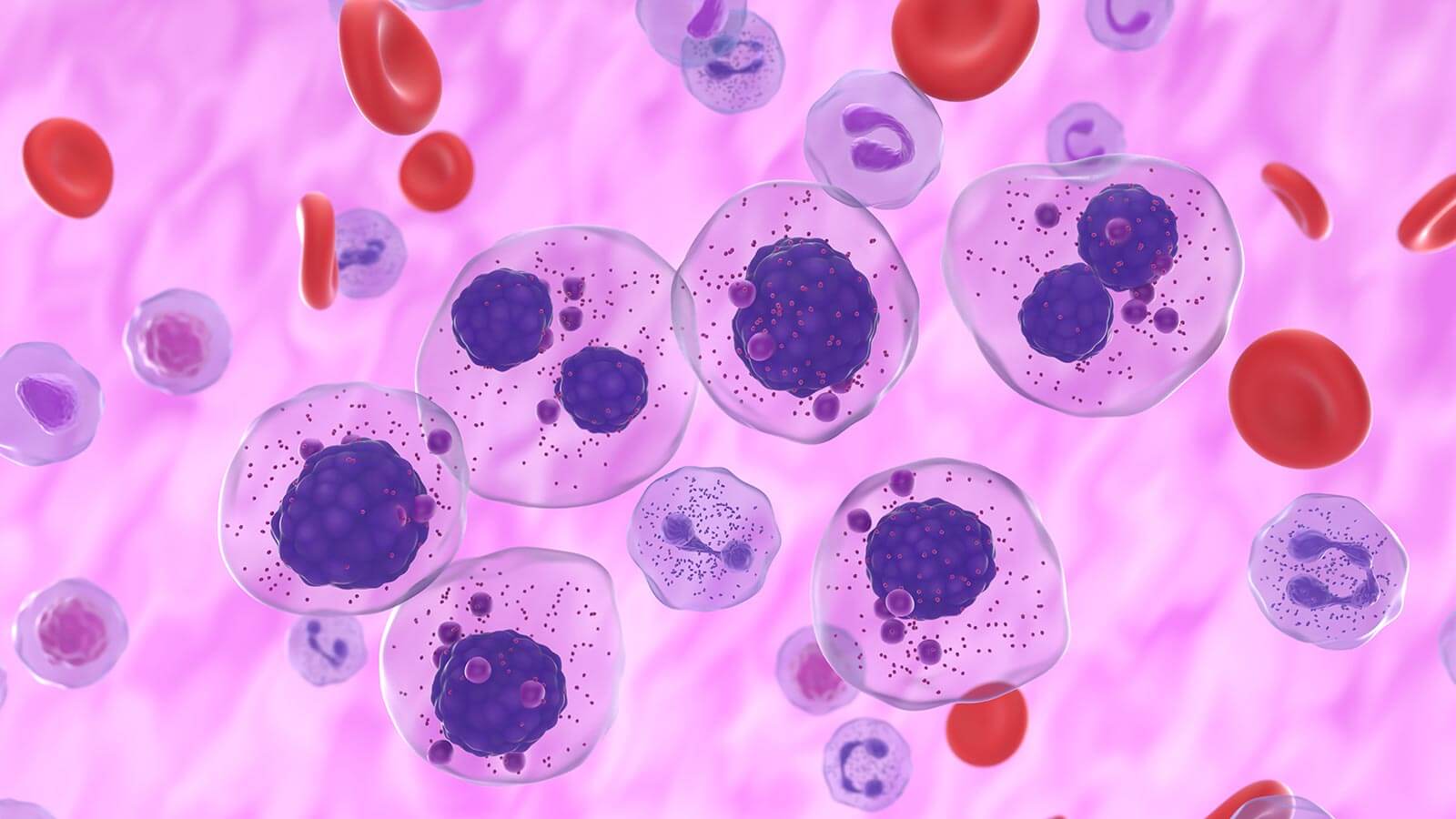 multiple myeloma cells