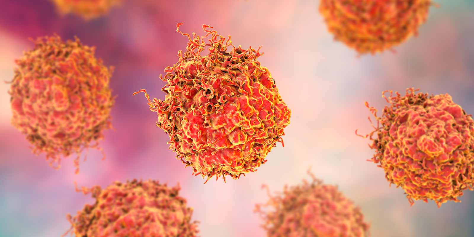 Prostate Cancer Cells