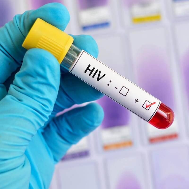 HIV testing