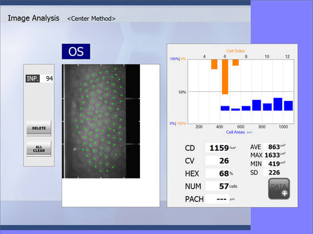 center method image analysis
