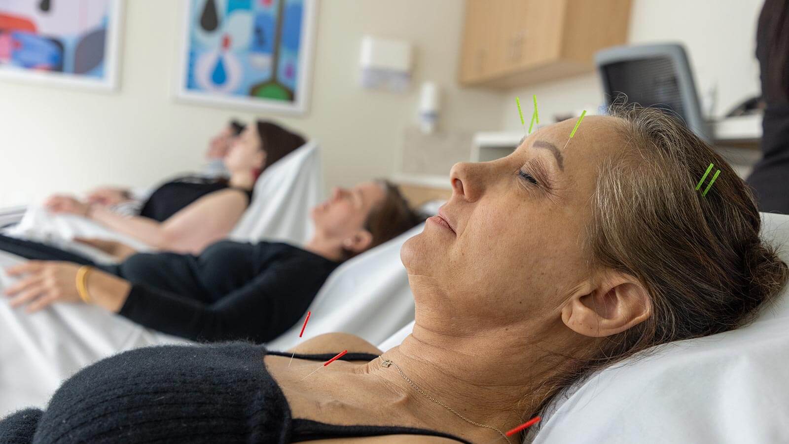 patients receiving acupuncture