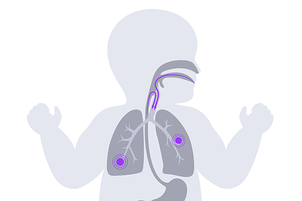 newborn respiratory issues