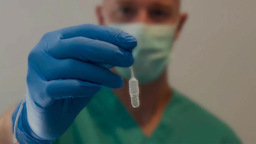 EsoCheck swallowable balloon device