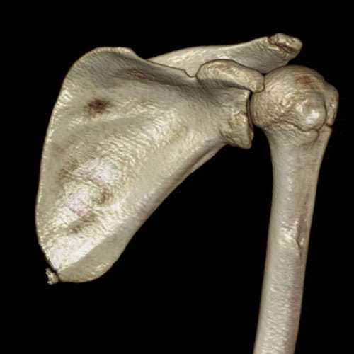 Musculoskeletal Image