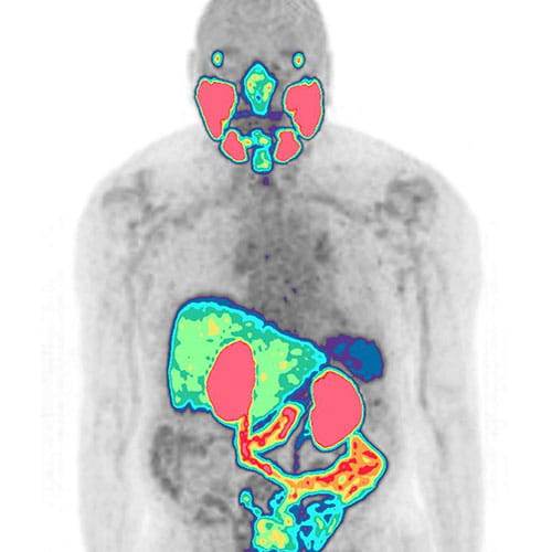 nuclear medicine image