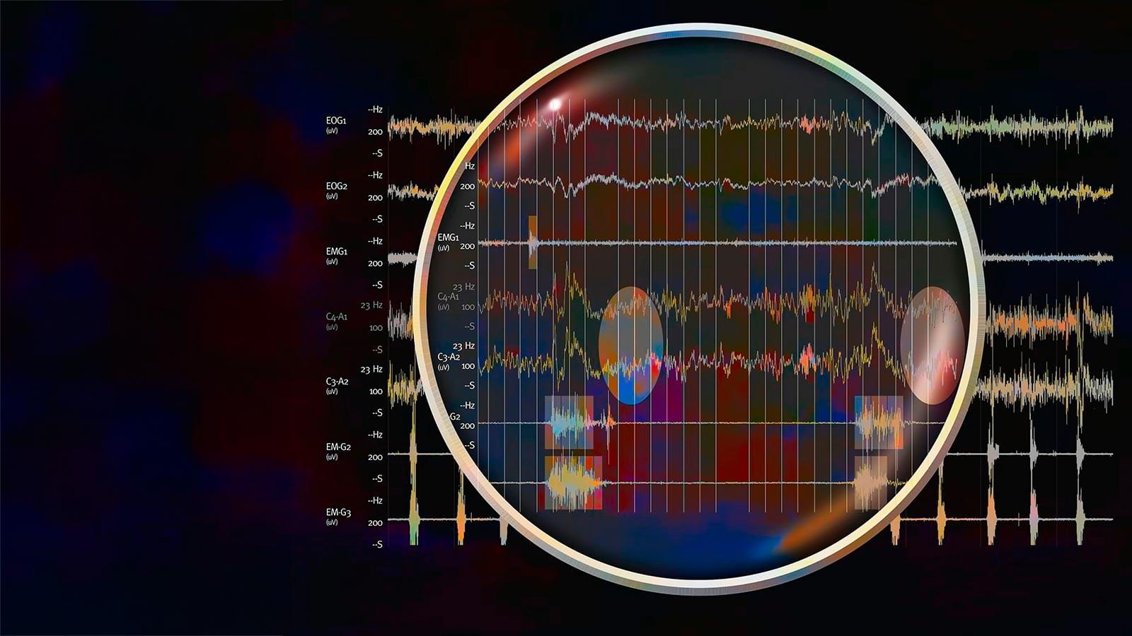 Polysomnography