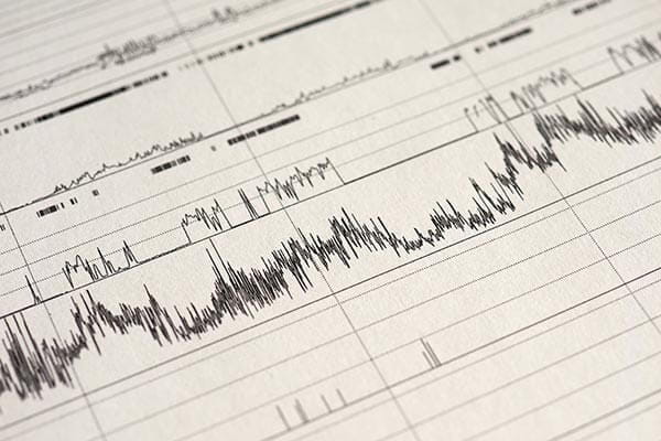 polysomnography test results