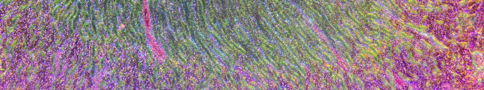 microscopic section of kidney tissue